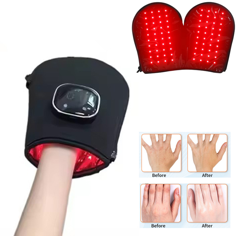 Red Light Therapy Device - 손을 위한 새로운 레드 라이트 테라피